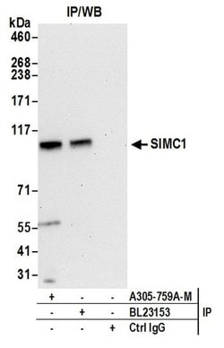 SIMC1 Polyclonal Antibody, Bethyl Laboratories 20 &mu;l; Unlabeled:Antibodies,
