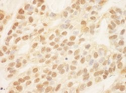 SIP1 Rabbit anti-Human, Polyclonal, Bethyl Laboratories 100 &mu;L; Unconjugated:Antibodies,