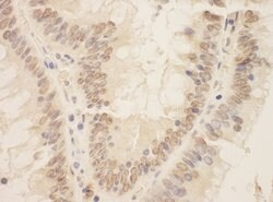 SIP1 Rabbit anti-Human, Polyclonal, Bethyl Laboratories 100 &mu;L; Unconjugated:Antibodies,