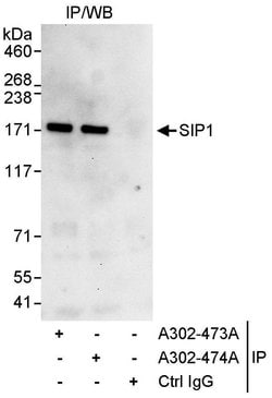 SIP1 Rabbit anti-Human, Polyclonal, Bethyl Laboratories 100 &mu;L; Unconjugated:Antibodies,