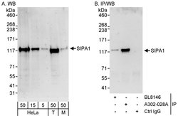 SIPA1 Rabbit anti-Human, Mouse, Polyclonal, Bethyl Laboratories 100 &mu;l;