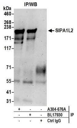SIPA1L2 Rabbit anti-Human, Polyclonal, Bethyl Laboratories 100 &mu;L; Unconjugated:Antibodies,