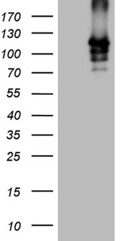 SIRT1 Mouse anti-Human, Clone: OTI1H1, lyophilized, TrueMAB 100 &mu;g;
