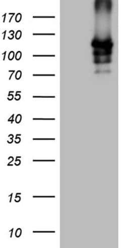 SIRT1 Monoclonal Antibody (OTI1H1), TrueMAB , OriGene 100 &mu;L; Unconjugated:Antibodies,