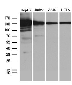 SIRT1 Monoclonal Antibody (OTI1H1), TrueMAB , OriGene 100 &mu;L; Unconjugated:Antibodies,