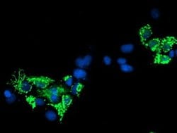 SIRT5 Monoclonal Antibody (OTI2F1), TrueMAB , OriGene 100 &mu;L; Unconjugated:Antibodies,