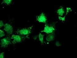 SIRT5 Monoclonal Antibody (OTI 1G5), TrueMAB , OriGene 30 &mu;L; Unconjugated:Antibodies,