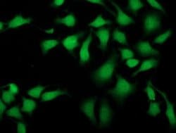 SIRT5 Monoclonal Antibody (OTI2A11), TrueMAB , OriGene 100 &mu;L; Unconjugated:Antibodies,
