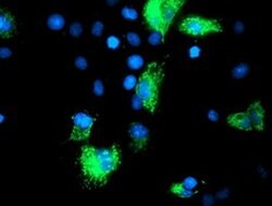 SIRT5 Monoclonal Antibody (OTI 2E12), TrueMAB , OriGene 30 &mu;L; Unconjugated:Antibodies,