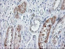 SIRT5 Monoclonal Antibody (OTI2F1), TrueMAB , OriGene 100 &mu;L; Unconjugated:Antibodies,