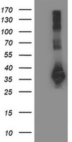 SIRT5 Monoclonal Antibody (OTI2F1), TrueMAB , OriGene 100 &mu;L; Unconjugated:Antibodies,