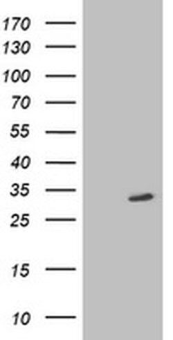 SIRT5 Monoclonal Antibody (OTI2C4), TrueMAB , OriGene 100 &mu;L; Unconjugated:Antibodies,