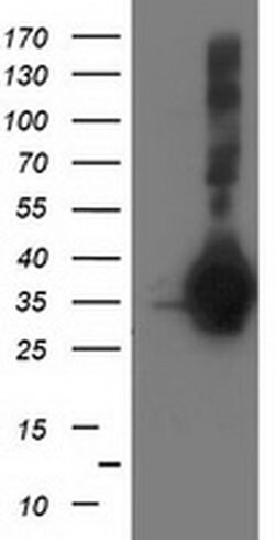 SIRT5 Monoclonal Antibody (OTI 1G9), TrueMAB , OriGene 100 &mu;L; Unconjugated:Antibodies,