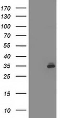 SIRT5 Monoclonal Antibody (OTI 1G5), TrueMAB , OriGene 30 &mu;L; Unconjugated:Antibodies,