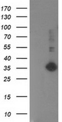 SIRT5 Monoclonal Antibody (OTI2E10), TrueMAB , OriGene:Antibodies:Primary