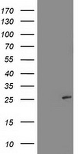 SIRT5 Monoclonal Antibody (OTI 2E12), TrueMAB , OriGene:Antibodies:Primary