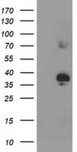 SIRT6 Mouse anti-Human, Clone: OTI1G3, liquid, TrueMAB 30 &mu;L; Unconjugated:Antibodies,