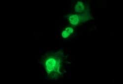 SIVA1 Monoclonal Antibody (OTI2F8), TrueMAB , OriGene 100 &mu;L; Unconjugated:Antibodies,