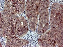 SIVA1 Monoclonal Antibody (OTI1C9), TrueMAB , OriGene 100 &mu;L; Unconjugated:Antibodies,