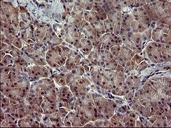 SIVA1 Monoclonal Antibody (OTI1C9), TrueMAB , OriGene 100 &mu;L; Unconjugated:Antibodies,