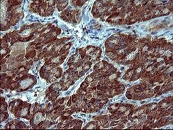 SIVA1 Monoclonal Antibody (OTI1C9), TrueMAB , OriGene 100 &mu;L; Unconjugated:Antibodies,