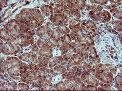 SIVA1 Mouse anti-Human, Clone: OTI1G8, lyophilized, TrueMAB 100 &mu;g;