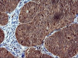 SIVA1 Monoclonal Antibody (OTI2F8), TrueMAB , OriGene:Antibodies:Primary