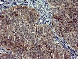 SIVA1 Monoclonal Antibody (OTI2D3), TrueMAB , OriGene:Antibodies:Primary