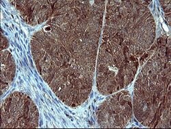 SIVA1 Monoclonal Antibody (OTI2B7), TrueMAB , OriGene 100 &mu;L; Unconjugated:Antibodies,