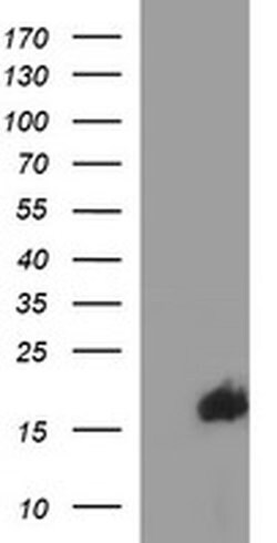 SIVA1 Monoclonal Antibody (OTI2F8), TrueMAB , OriGene 100 &mu;L; Unconjugated:Antibodies,