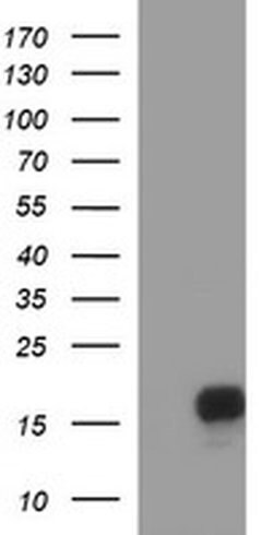 SIVA1 Monoclonal Antibody (OTI2D3), TrueMAB , OriGene 100 &mu;L; Unconjugated:Antibodies,