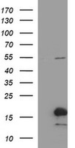 SIVA1 Monoclonal Antibody (OTI2B7), TrueMAB , OriGene 100 &mu;L; Unconjugated:Antibodies,