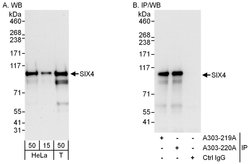 SIX4 Rabbit anti-Human, Polyclonal, Bethyl Laboratories 100 &mu;L; Unconjugated:Antibodies,
