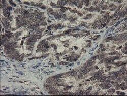 SKIL Monoclonal Antibody (OTI1A6), TrueMAB , OriGene:Antibodies:Primary