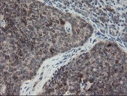SKIL Monoclonal Antibody (OTI1A6), TrueMAB , OriGene:Antibodies:Primary