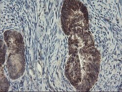 SKIL Monoclonal Antibody (OTI1A6), TrueMAB , OriGene 30 &mu;L; Unconjugated:Antibodies,
