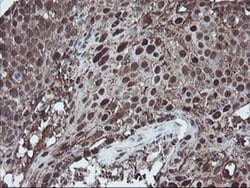 SKIL Monoclonal Antibody (OTI3E2), TrueMAB , OriGene 100 &mu;L; Unconjugated:Antibodies,