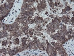 SKIL Monoclonal Antibody (OTI3E2), TrueMAB , OriGene 100 &mu;L; Unconjugated:Antibodies,