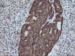 SKIL Monoclonal Antibody (OTI3E2), TrueMAB , OriGene 100 &mu;L; Unconjugated:Antibodies,