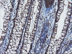 SKIL Monoclonal Antibody (OTI3E2), TrueMAB , OriGene 100 &mu;L; Unconjugated:Antibodies,