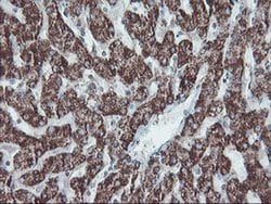 SKIL Monoclonal Antibody (OTI3E2), TrueMAB , OriGene 100 &mu;L; Unconjugated:Antibodies,