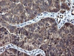 SKIL Monoclonal Antibody (OTI3E9), TrueMAB , OriGene 100 &mu;L; Unconjugated:Antibodies,