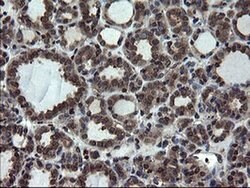SKIL Monoclonal Antibody (OTI3E9), TrueMAB , OriGene:Antibodies:Primary