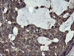 SKIL Monoclonal Antibody (OTI3E9), TrueMAB , OriGene 100 &mu;L; Unconjugated:Antibodies,