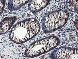 SKIL Monoclonal Antibody (OTI3E9), TrueMAB , OriGene 100 &mu;L; Unconjugated:Antibodies,