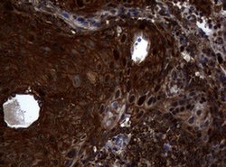 SKIL Monoclonal Antibody (OTI2C9), TrueMAB , OriGene 100 &mu;L; Unconjugated:Antibodies,