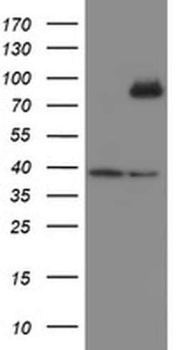 SKIL Monoclonal Antibody (OTI3E2), TrueMAB , OriGene 100 &mu;L; Unconjugated:Antibodies,