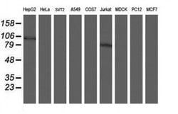 SKIL Monoclonal Antibody (OTI1H2), TrueMAB , OriGene:Antibodies:Primary