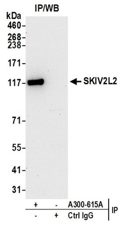 SKIV2L2 Rabbit anti-Human, Polyclonal, Bethyl Laboratories 10 &mu;L; Unconjugated:Antibodies,