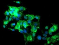 SLA2 Monoclonal Antibody (OTI2G3), TrueMAB , OriGene 100 &mu;L; Unconjugated:Antibodies,